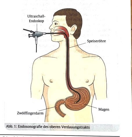 Magenspiegelung
